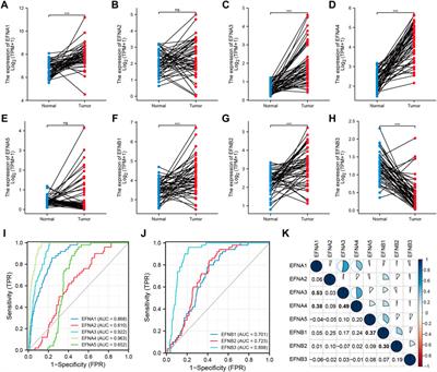 A comprehensive prognostic and immunological analysis of ephrin family genes in hepatocellular carcinoma